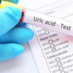 ইউরিক অ্যাসিডের সমস্যা, কি খাবেন, কি খাবেন না যেনে নিন