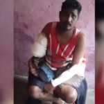 ভেঙেছে বাম হাত, অস্ত্রোপচার করাতে গিয়ে ডাক্তার কেটে বাদ দিলেন ডান হাত