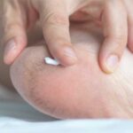 শুকনো ফাটা হিল নিয়ে সমস্যায় পড়েছেন? এগুলি থেকে মুক্তি পাওয়ার এই প্রাকৃতিক উপায়গুলি জেনেনিন