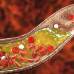 কোলেস্টেরল থেকে আয়ুর্বেদিক উপায়ে মুক্তি পেতে খান এই খাবার গুলি