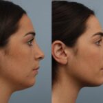 ভারী গাল, ডাবল চিন? করুন এই ৫ সহজ ব্যায়াম…