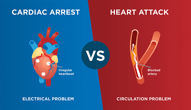 Difference between cardiac arrest and heart attack