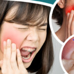 আক্কেল দাঁতে ব্যথা? রইল কয়েকটি ঘরোয়া টোটকা