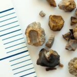 শুধু কিডনিই নয়… শরীরের এই ৬টি অংশেও পাথর তৈরি হতে পারে, এড়াতে অবিলম্বে করুন এই কাজ গুলি