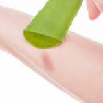 গরম জলে পুড়ে গেলে এই ৪ টি জিনিস লাগান, আরাম পাবেন