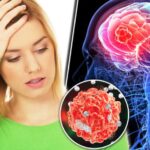 ব্রেন টিউমারের 8টি সাধারণ লক্ষণ যা কখনই উপেক্ষা করা উচিত নয়