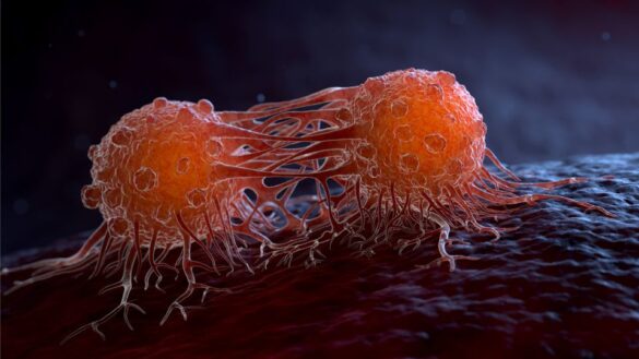 India is cancer capital of the world Apollo Hospital cancer Report