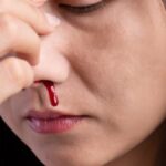 গরমে নাক দিয়ে রক্ত পড়ে, জেনে নিন প্রতিরোধের ৫ টি উপায়