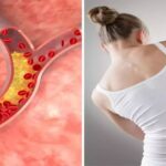 উচ্চ কোলেস্টেরলের লক্ষণ: কোলেস্টেরল বেড়ে গেলে শরীরের এই ৫টি অংশে ব্যথা হয়! অন্যান্য লক্ষণগুলি জানুন