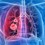 ফুসফুসের রোগকে দূরে রাখতের এড়িয়ে চলুন এই ৭ টি অভ্যাস! তারা ধীরে ধীরে এভাবে শরীরে আক্রমণ করে