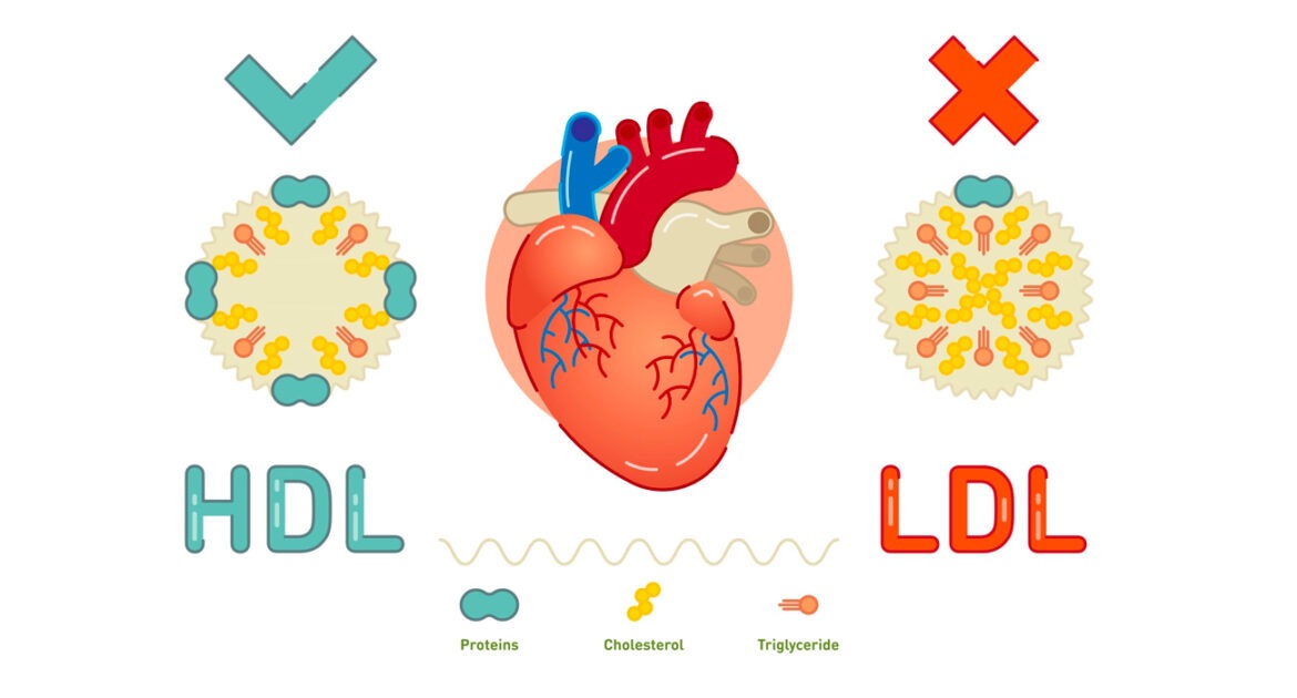 Learn how to balance good(HDL) and bad(LDL) cholesterol for a healthy heart