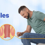 পাইলসের ব্যথা কি আপনার জীবন নষ্ট করছে? প্রতিদিন এই পানীয়গুলি পান করুন, আপনি শীঘ্রই সুস্থ হয়ে উঠবেন।