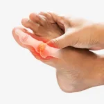 Uric acid বেড়ে গেলে কতটা বিপজ্জনক হতে পারে? এই প্রাকৃতিক পদ্ধতিগুলি ব্যবহার করে এটি নিয়ন্ত্রণ করুন