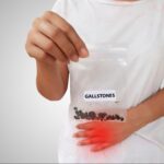 ৬টি খাবার যা পিত্ত থলিতে পাথর সৃষ্টি করতে পারে এবং কীভাবে এটি প্রতিরোধ করা যায়