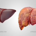 শুধু অ্যালকোহলই নয়! এই ৬টি সাধারণ অভ্যাসও আপনার লিভারের ক্ষতি করছে