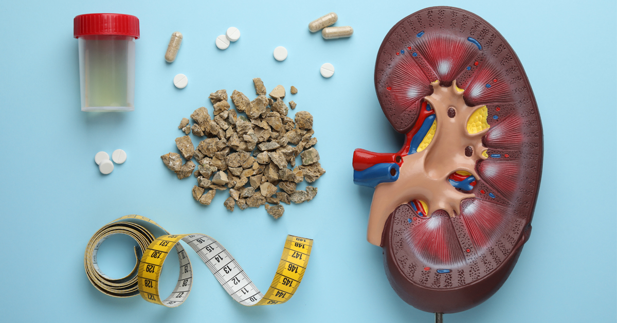 7 natural remedies you can do at home to remove kidney stone