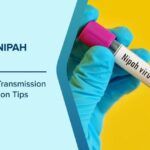নিপা ভাইরাস কি? লক্ষণ, ঝুঁকি এবং কীভাবে এটি থেকে নিরাপদ থাকবেন তা জানুন