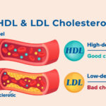 Hdl vs ldl vs triglycerides কি? এগুলি কীভাবে পরিচালনা করা যায়