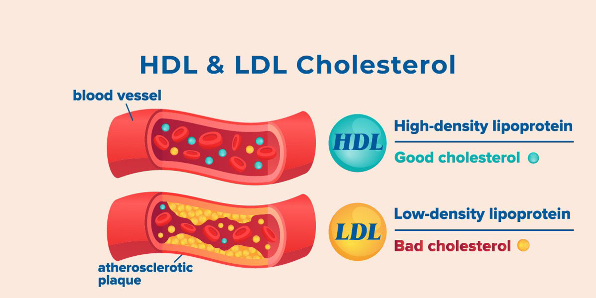 Hdl vs ldl vs triglycerides কি? এগুলি কীভাবে পরিচালনা করা যায়