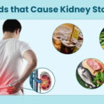কিডনিতে পাথরের নাম শুনলেই ভয় পান? মাংস, ক্যাফেইন, জুস সহ এই ৭টি খাবার এড়িয়ে চলুন