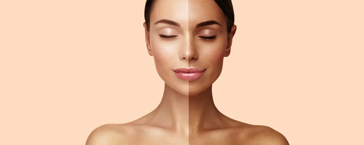 Know 5 useful remedies to remove skin tanning, which can be removed with things found at home