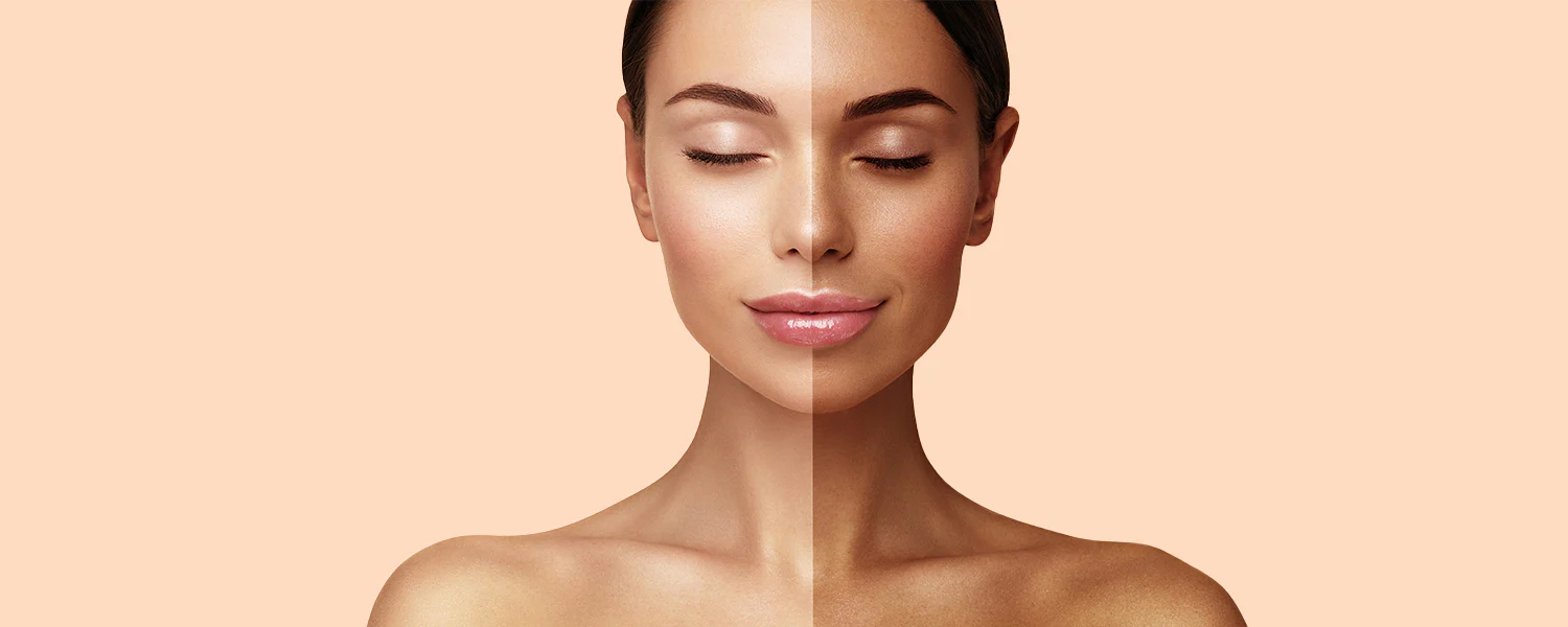 ত্বকের ট্যানিং দূর করার ৫টি উপকারী প্রতিকার, বাড়িতে পাওয়া জিনিস দিয়ে দূর করা যেতে পারে, জানুন