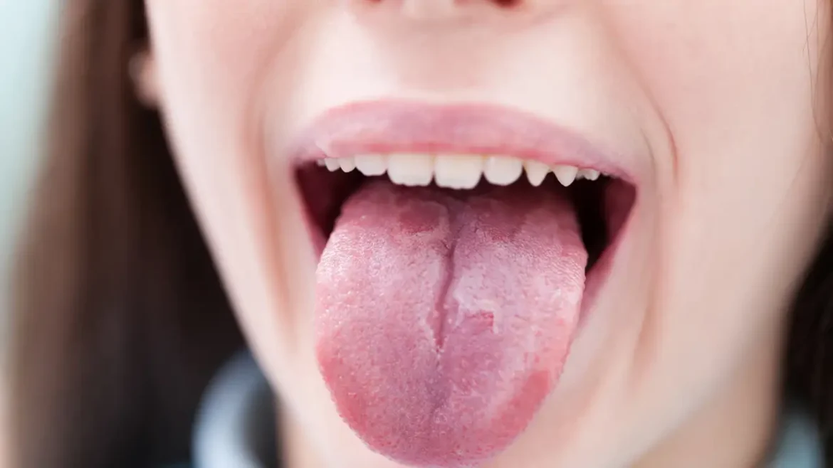 Do you know what your tongue says about your heart health?