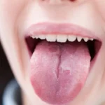 আপনি কি জানেন আপনার জিহ্বা আপনার হৃদরোগের স্বাস্থ্য সম্পর্কে কি কি বলে