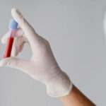 আপনার রক্ত​কি পাতলা না ঘন? কিভাবে তা বুজবেন একজন ডাক্তারের কাছে জানুন