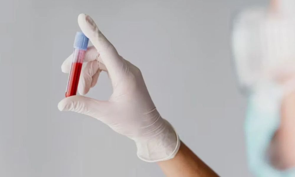 Is your blood thin or thick? Find out how to tell from a doctor