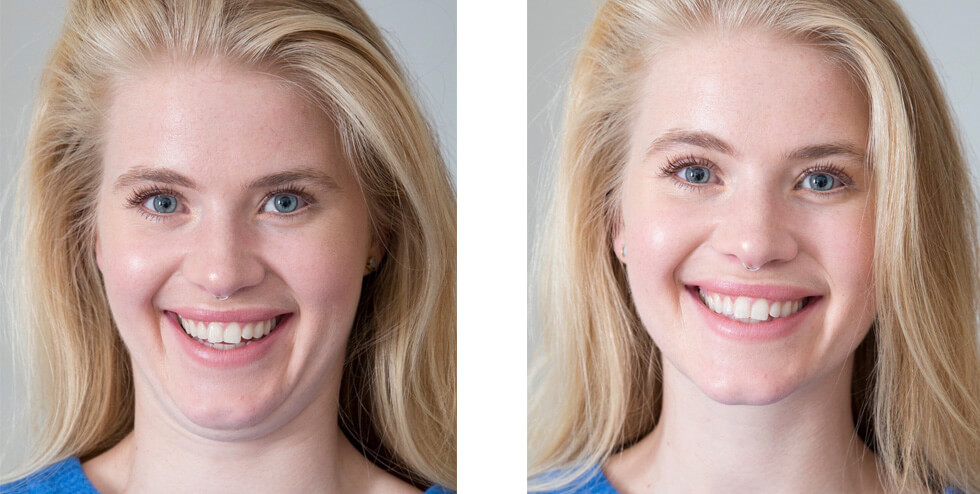 Want to get rid of double chin? Do this exercise for just 15 minutes every day