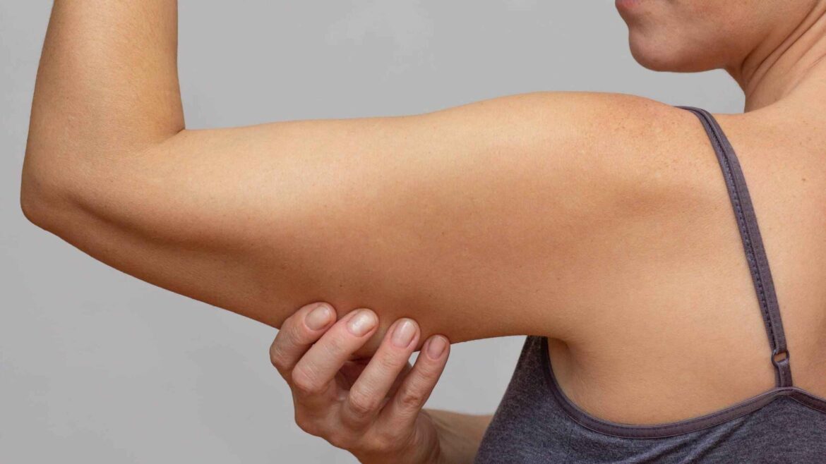 Why does skin sag after weight loss, 3 ways to prevent it explained by a nutritionist, know