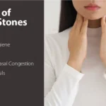 টনসিলের পাথর কি? কীভাবে প্রতিরোধ করবেন, করণীয় এবং বর্জনীয় বিষয়গুলি আপনার অবশ্যই জানা উচিত