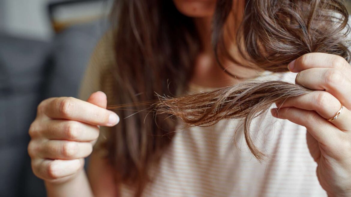 Know 5 signs of hair loss that indicate liver and kidney problems and why they require immediate treatment