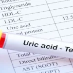 আপনার ঘন ঘন ইউরিক অ্যাসিডের মাত্রা বৃদ্ধি পাচ্ছে? ডাক্তারের কাছ থেকে জেনে নিন আপনার কীভাবে এটি নিয়ন্ত্রণ করবেন