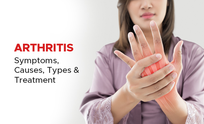 Learn why arthritis occurs and how to prevent it.