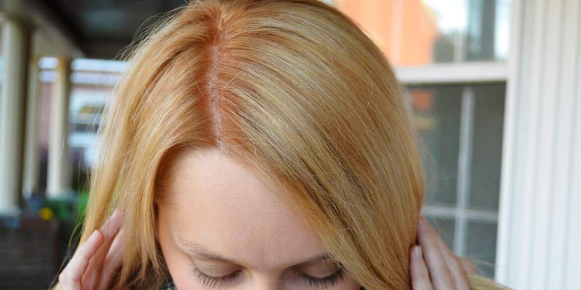 If you dye your hair, never make these mistakes; they will ruin your look.