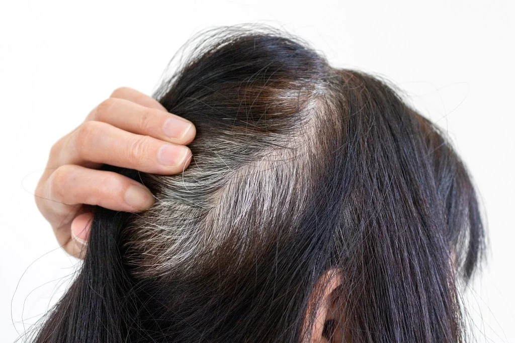 This vitamin is effective in many problems such as hair loss, breakage, and premature graying.