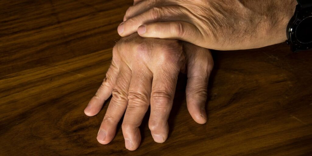 ডায়াবেটিস রোগীদের হাড়ও কি দুর্বল হয়ে পড়ে? ডাক্তারের কাছ থেকে জেনে নিন লক্ষণগুলি কেমন হয়