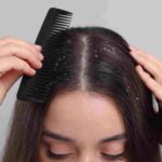 ঠাণ্ডা বাতাস, কম আর্দ্রতা এবং শুষ্ক মাথার ত্বক—শীতের চুলের যত্ন কেন বেশি গুরুত্বপূর্ণ?