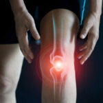 কেন শীতকালে আর্থ্রাইটিস বেশি যন্ত্রণাদায়ক হয়, অস্বস্তি কমানোর জন্য ৫টি কৌশল