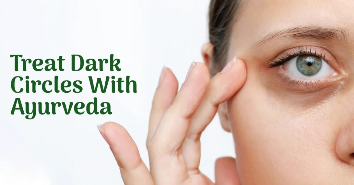 Do you have dark circles under your eyes, know the Ayurvedic remedy for it