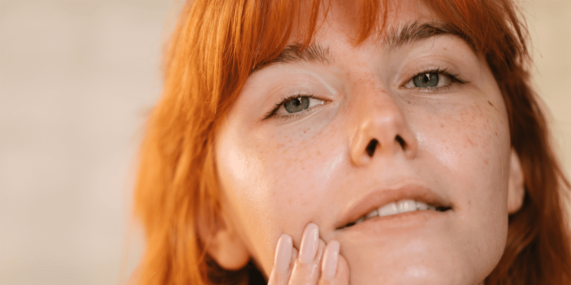 Find out from an expert whether oily foods cause acne.