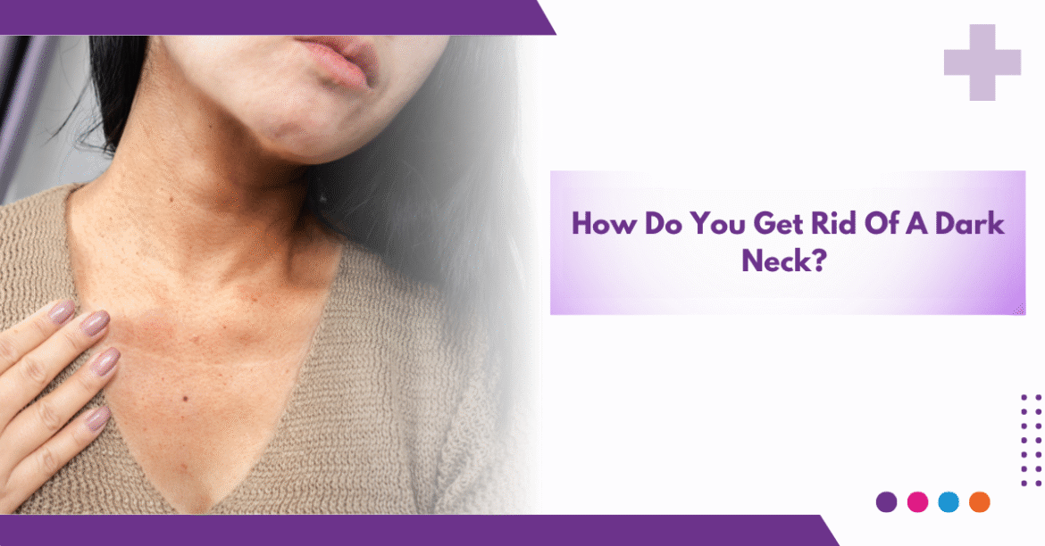 Try these home remedies to clean the dark neck, use them like this