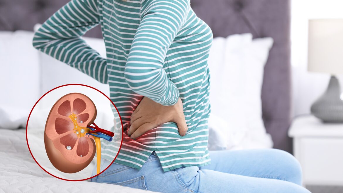Try this natural remedy to remove kidney stones, be careful