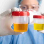 শীতকালে প্রস্রাবের রঙের পরিবর্তন কি অসুস্থতার লক্ষণ? বিশেষজ্ঞদের কাছ থেকে জেনে নিন