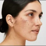 অকাল বার্ধক্য… এই ভিটামিনের অভাবের ফলে ত্বকে দাগ পড়তে পারে, এগুলো থেকে মুক্তি পাওয়ার উপায় এখানে জানুন