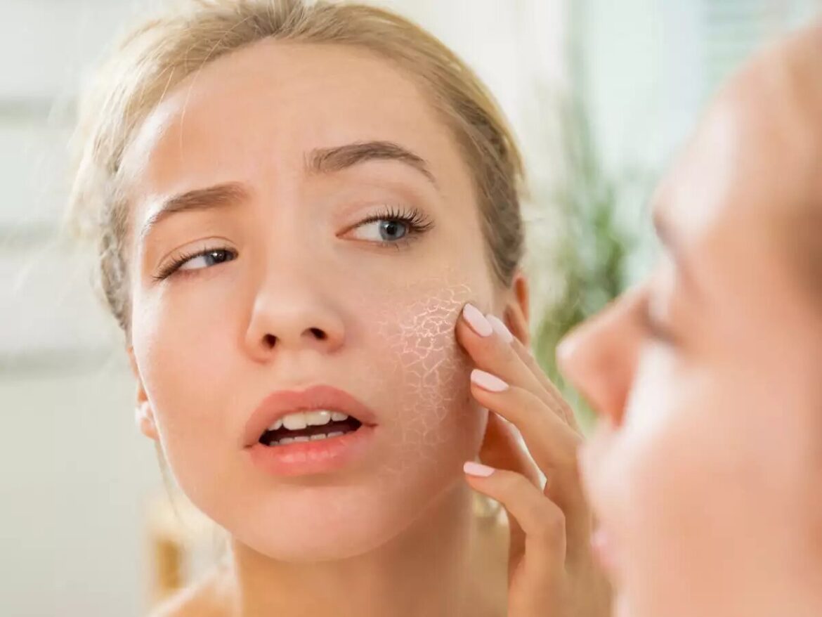 Find out from an expert what to do to combat dry skin problems during the winter.