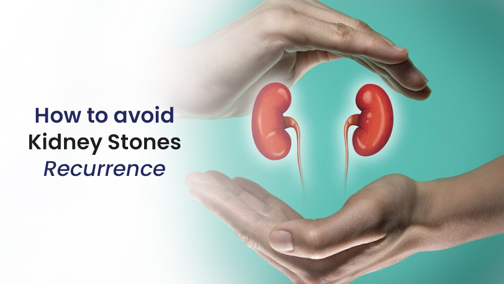 Do you have a tendency to develop kidney stones? Maintain these five daily habits to prevent them.
