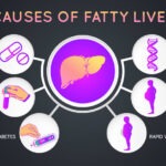ফ্যাটি লিভার ডায়াবেটিসের ঝুঁকি বাড়ায় কেন? জানুন